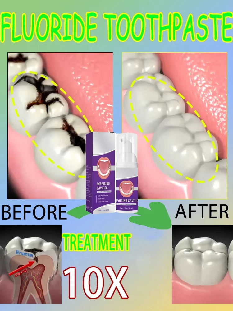 Teeth Whitening That Works - Ventas calientes Más vendido, reparaciones científicas