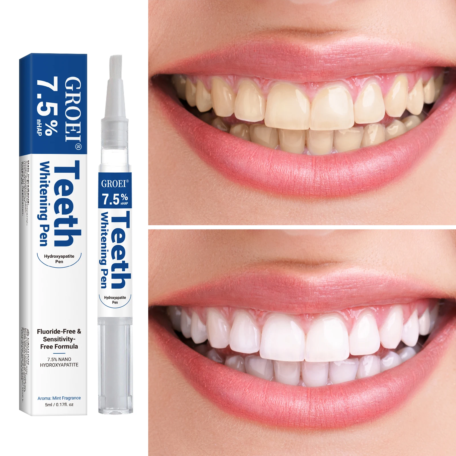 Pluma blanqueadora de dientes  - Teeth Whitening Remedies reseña y precio
