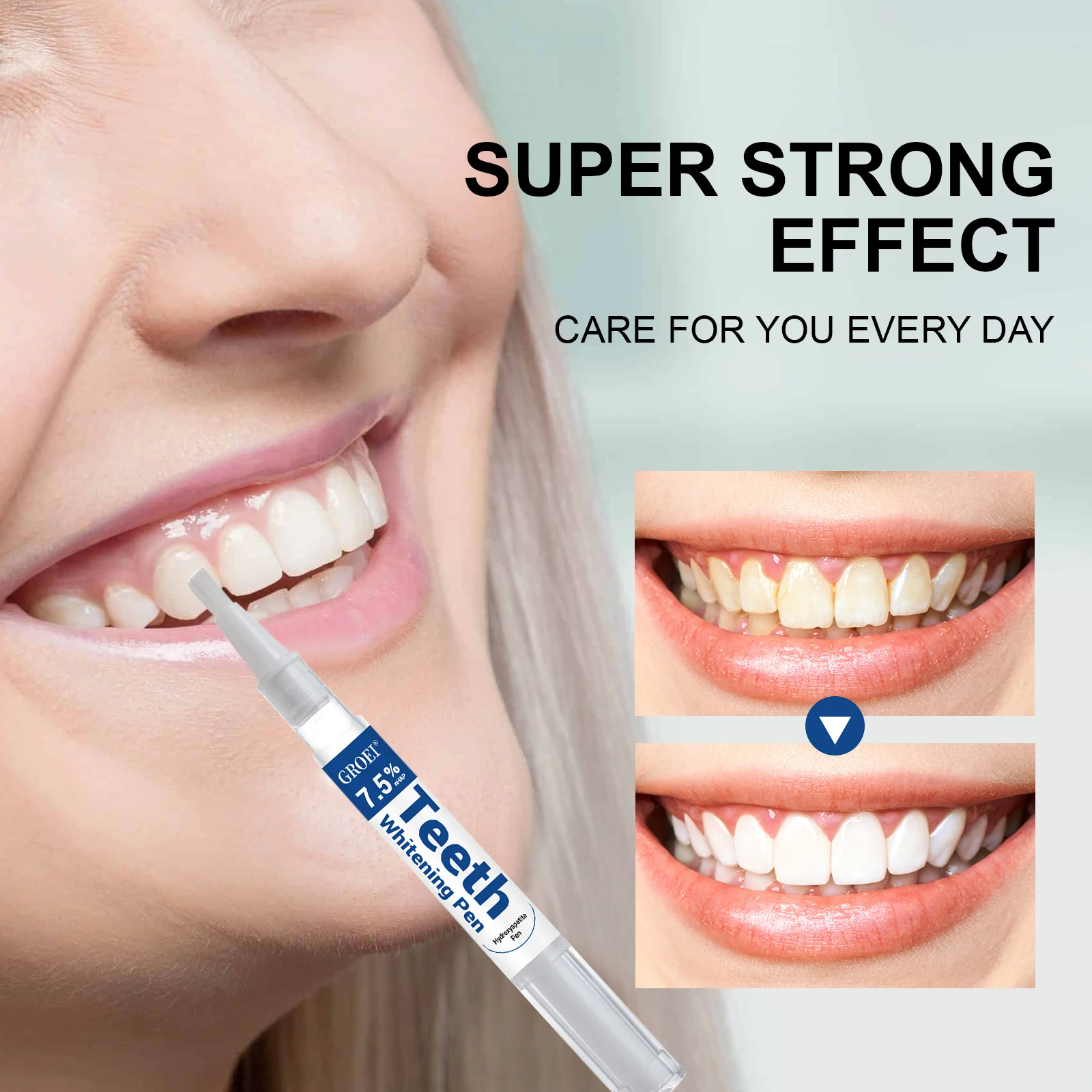 Pluma blanqueadora de dientes  - Teeth Whitening Remedies reseña y precio