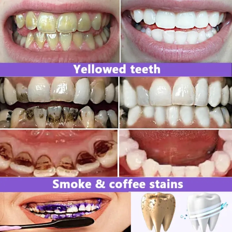 Pasta Dental Blanqueadora 2026 - Teeth Whitening Effective reseña y precio