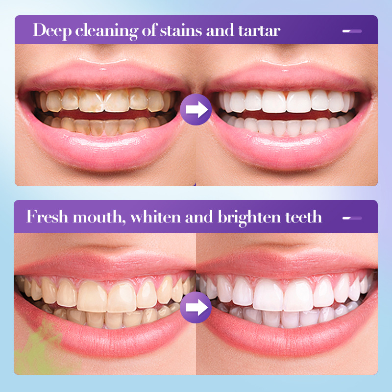 Pasta Dental Blanqueadora 2026 - Teeth Whitening Effective reseña y precio