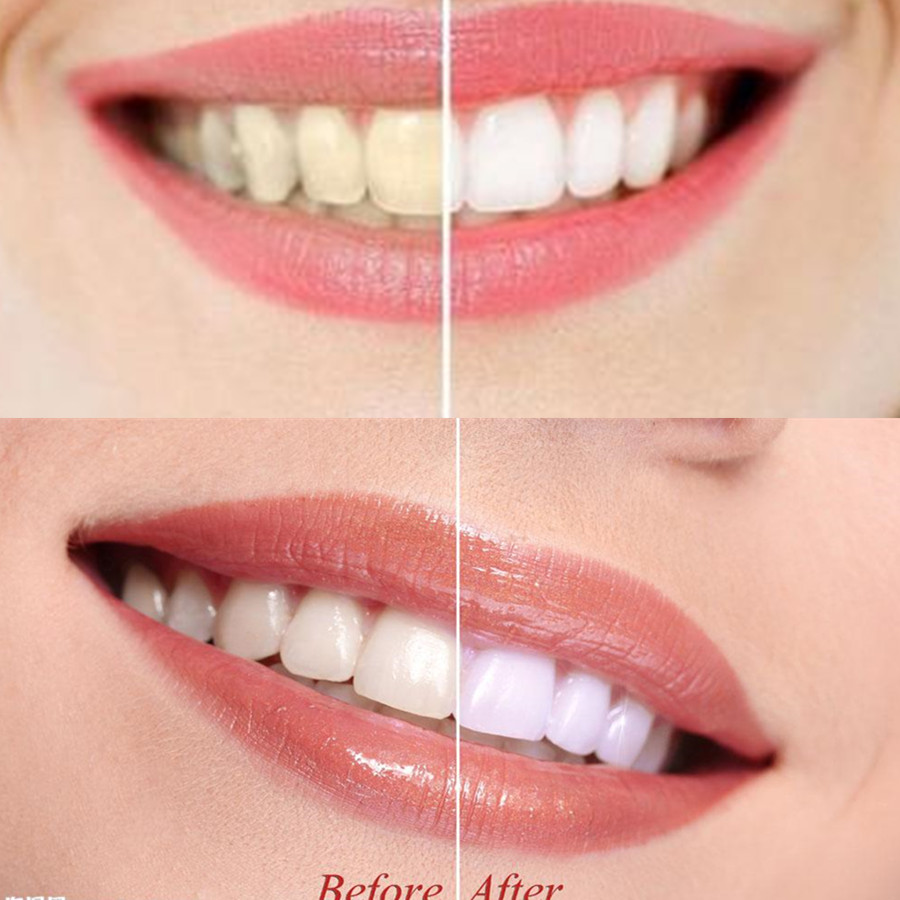 Dientes de carbón de bambú par - Teeth Whitening Results reseña y precio