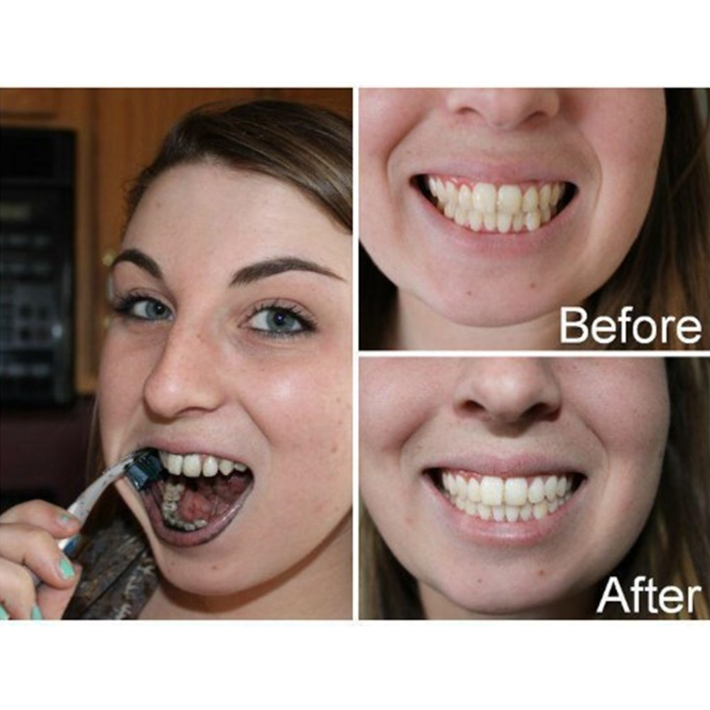 Dientes de carbón de bambú par - Teeth Whitening Results reseña y precio