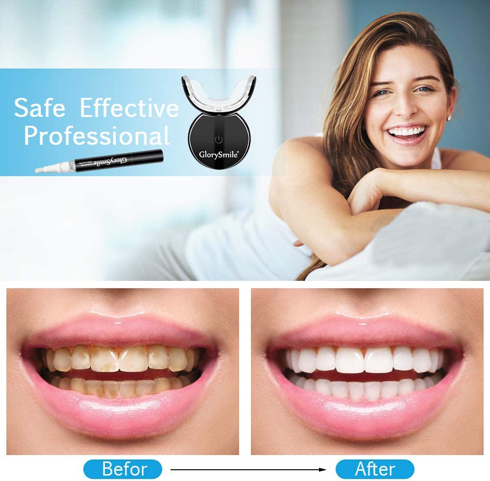 Kit de Blanqueamiento Dental L - Teeth Whitening Led Kit reseña y precio