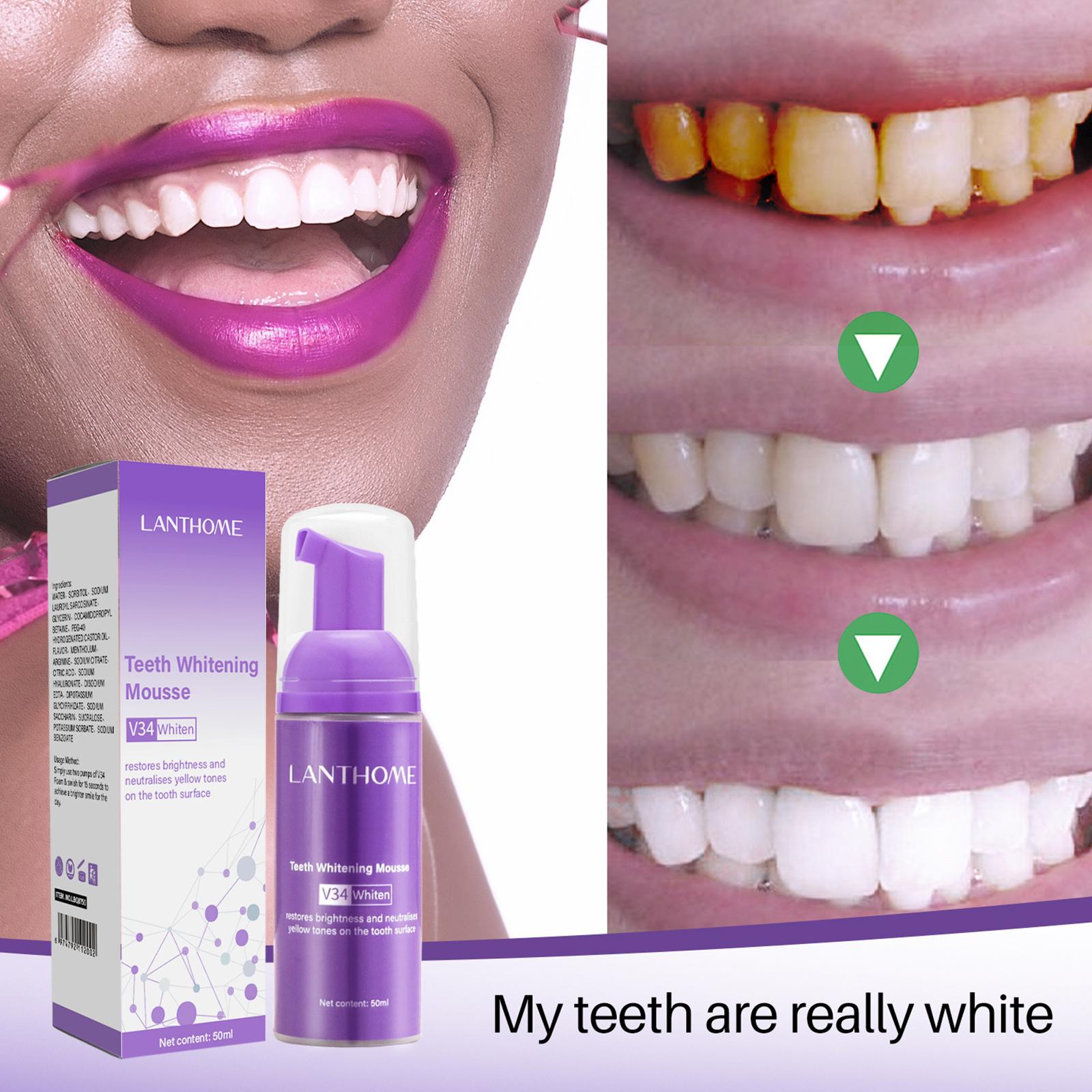 Pasta de dientes V34 Mousse pa - Teeth Whitening Effective reseña y precio