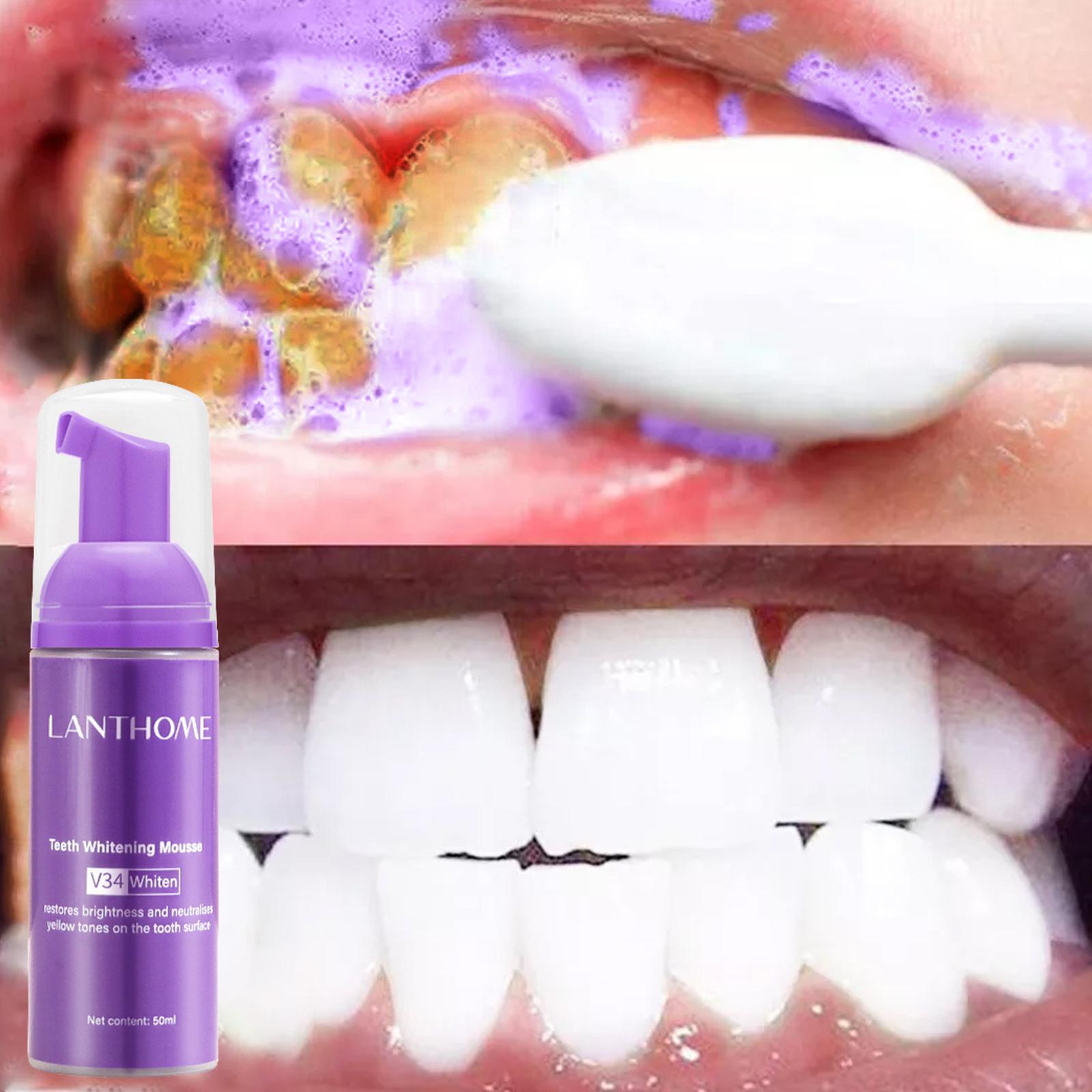 Pasta de dientes V34 Mousse pa - Teeth Whitening Effective reseña y precio