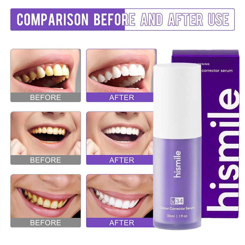    Suero Blanqueador Dental H - Teeth Whitening Crest reseña y precio