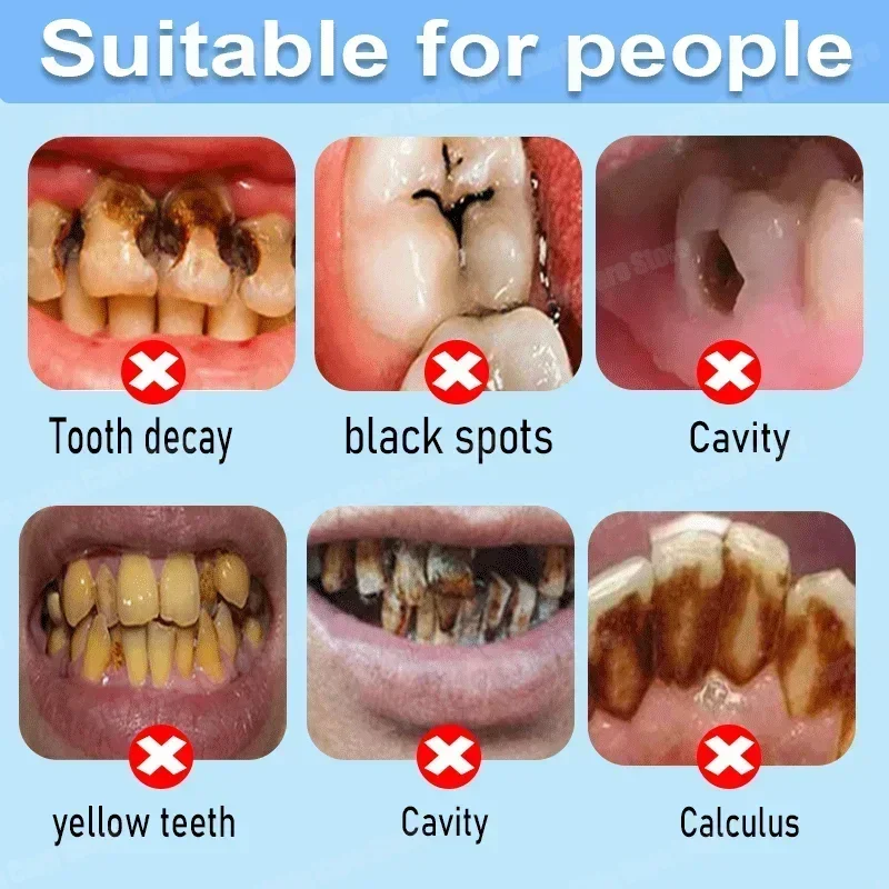 Pasta Dental Anticaries que Re - Teeth Whitening That Works reseña y precio