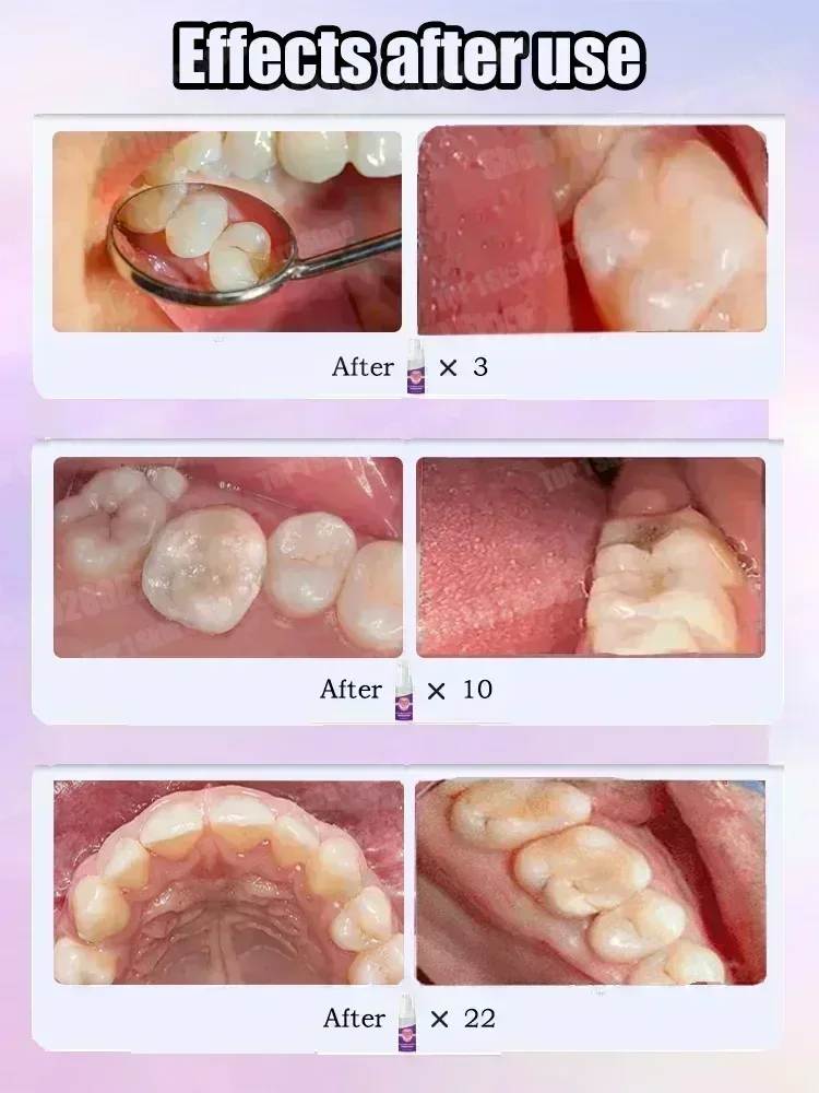 Ventas calientes Más vendido,  - Teeth Whitening Cream reseña y precio