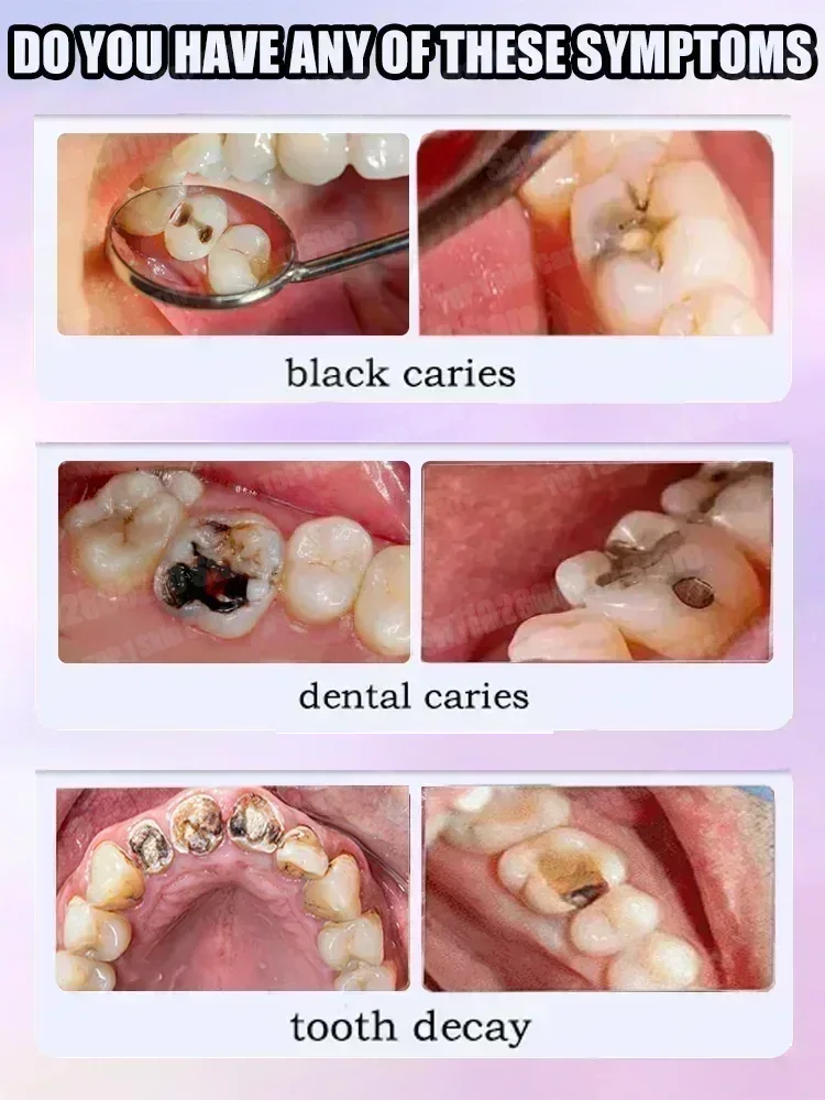 Ventas calientes Más vendido,  - Teeth Whitening Cream reseña y precio