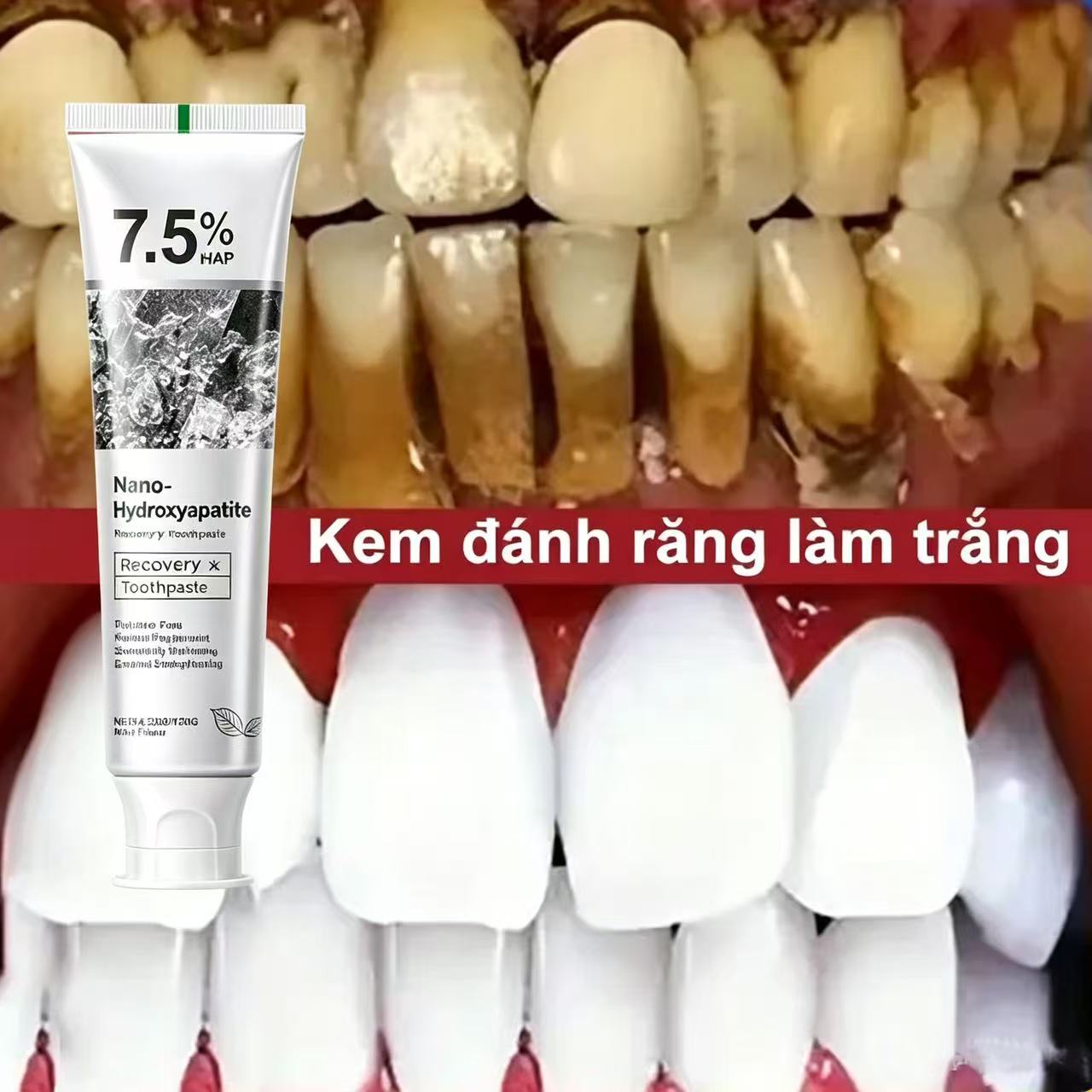Pasta Dental Blanqueadora Prob - Teeth Whitening That Works reseña y precio